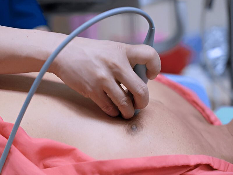 Echo (Echocardiogram)