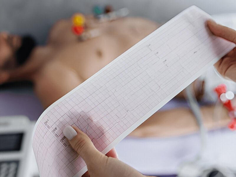 ECG (Electrocardiogram)